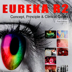 EUREKA R2 [Concept, principle & clinical cases] First edition