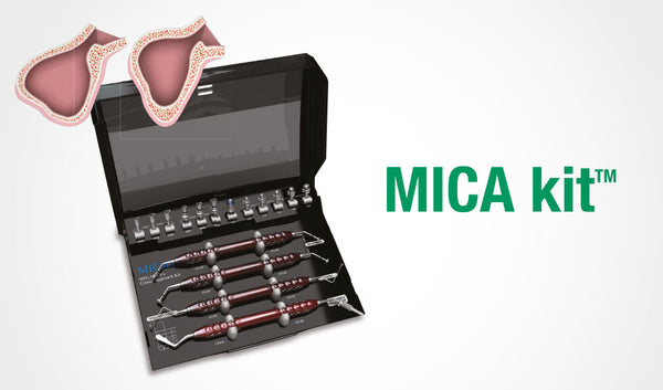 MICA & MILA Combination [Crestal & Laterall Sinus Lift Kit]
